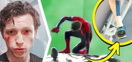 tom-holland-injured-spider-man-hospital